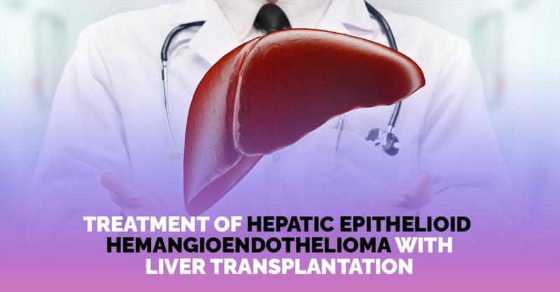 Unveiling Scientific Discoveries: The Impact of Liver Transplantation in Epithelioid Hemangioendothelioma