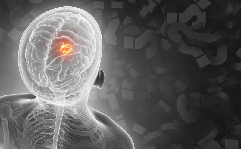 Massachusetts Institute of Technology: AI model can help determine where a patient’s cancer arose