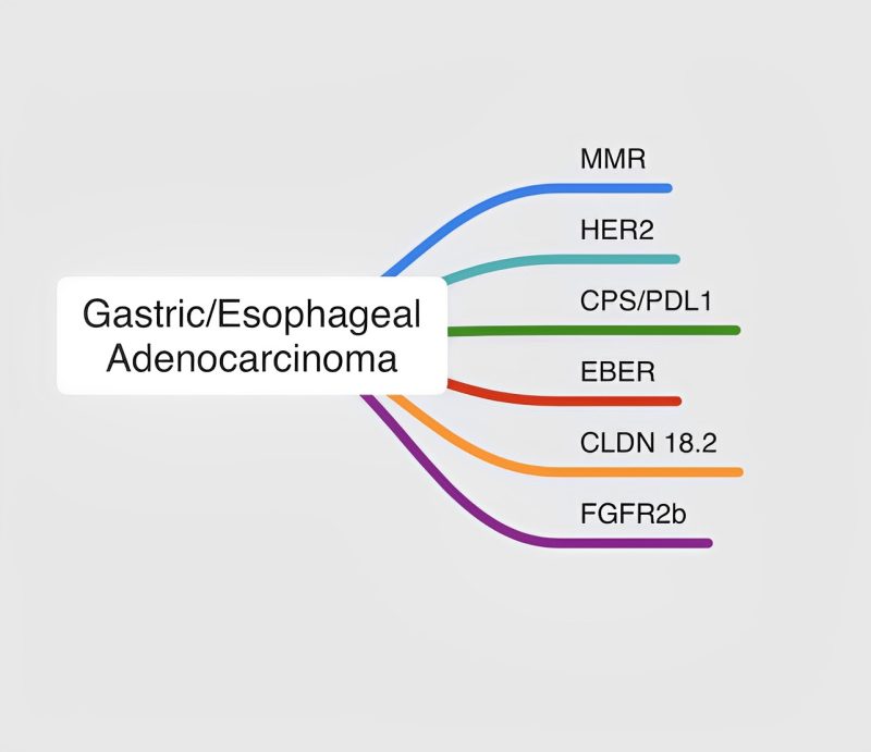 The list of biomarkers to consider Precision Medicine upfront is increasing – Pashtoon Kasi