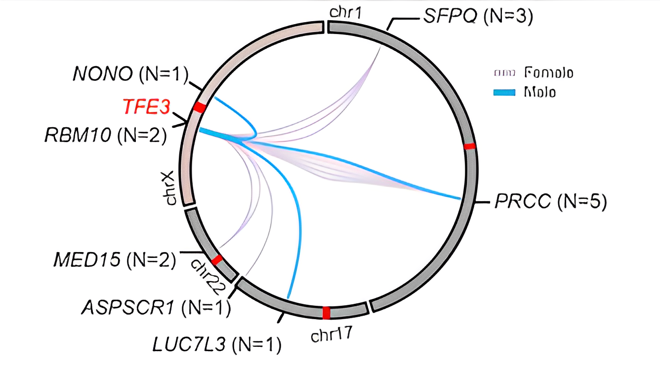 How chrX alterations may drive sex differences in cancer - Srinivas Viswanathan