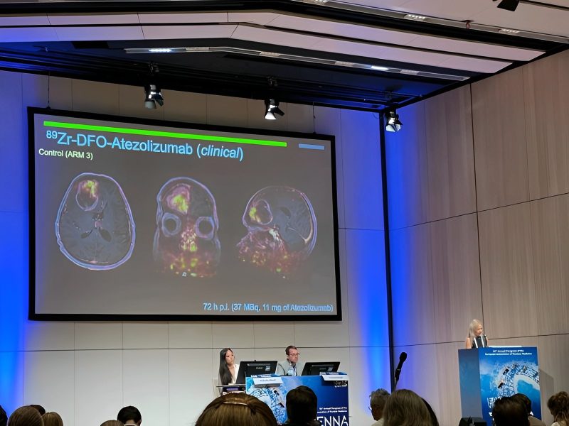 Gabriela Kramer-Marek: I have just presented the very first results of our recently initiated clinical study evaluating 89Zr-DFO-Atezolizumab in patients with newly diagnosed glioblastoma!