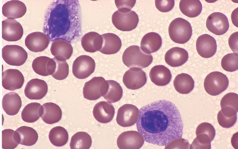 Registration is open for this year’s EHASWG Scientific Meeting on MDS/MPN/AML- Kordasti Lab