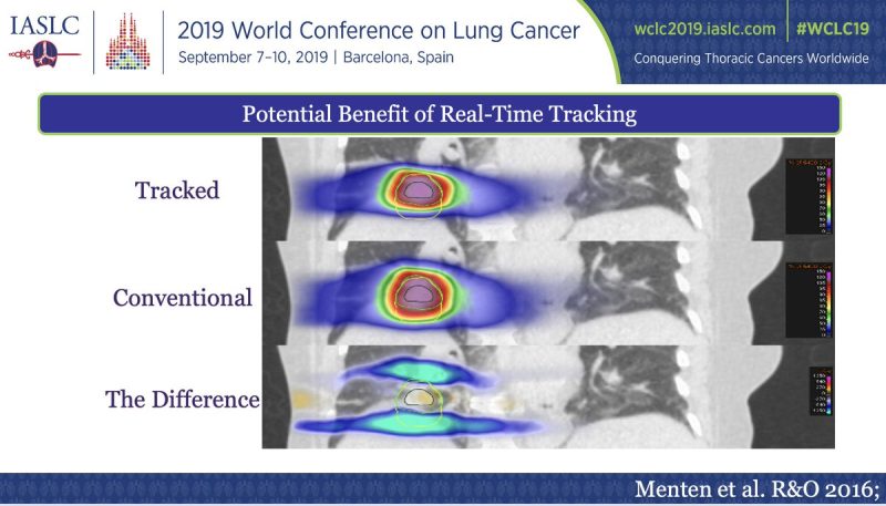 Drew Moghanaki: A slide presented by Fiona McDonald at WCLC19 teaches us