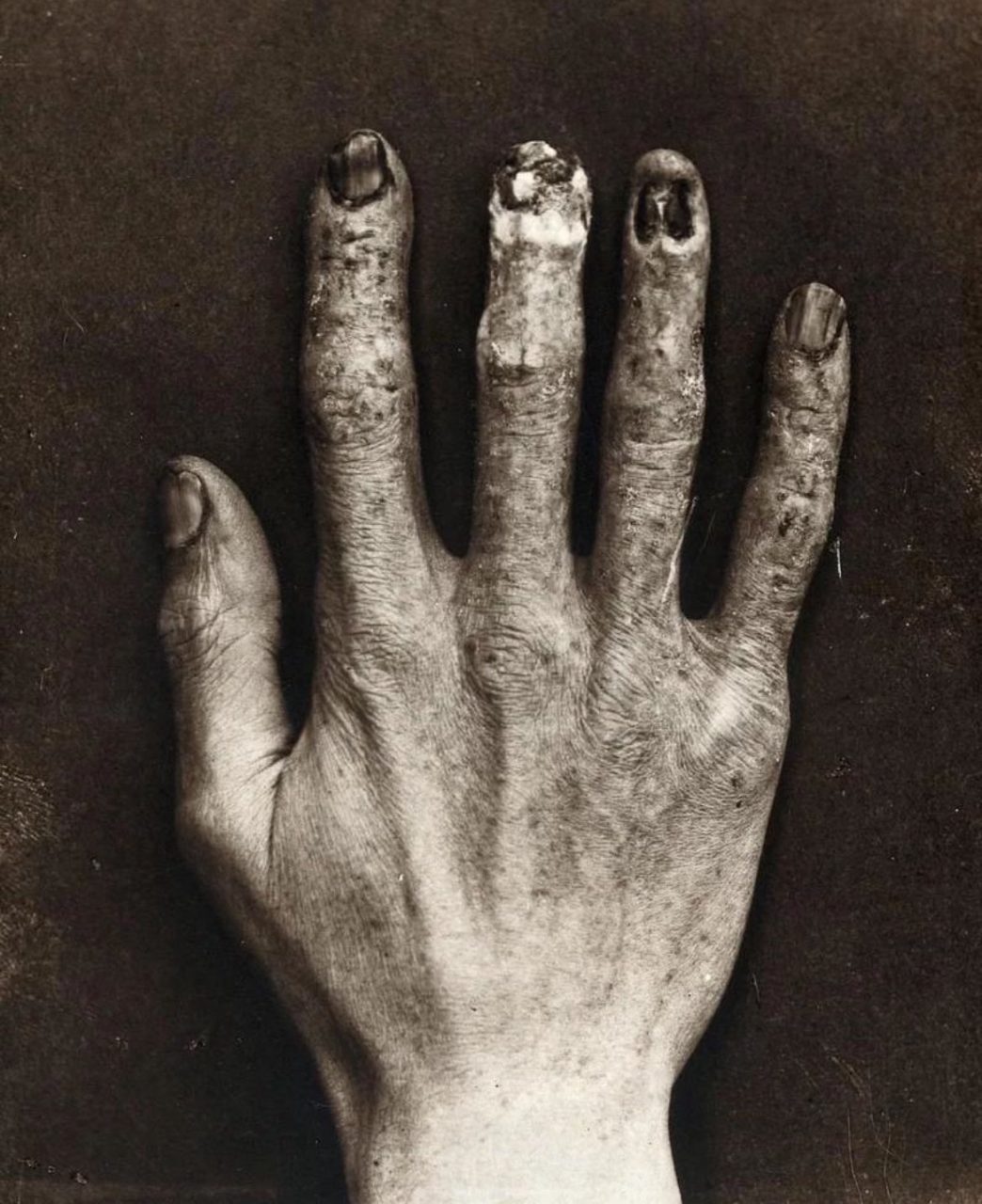 Hand belonging to an X-ray technician – Historic Vids