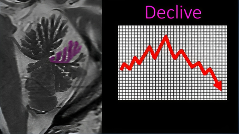 Lea Alhilali: How much cerebellar anatomy do YOU know?