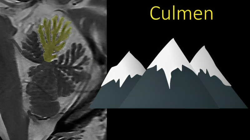 Lea Alhilali: How much cerebellar anatomy do YOU know?