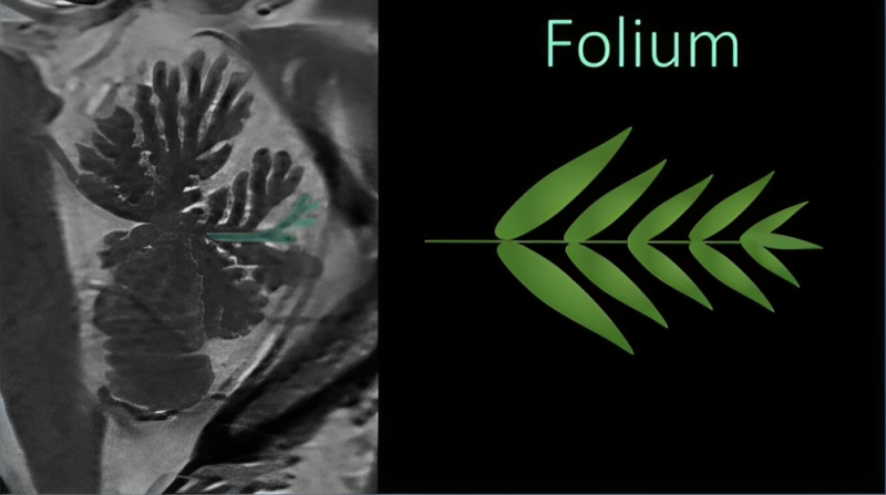 Lea Alhilali: How much cerebellar anatomy do YOU know?