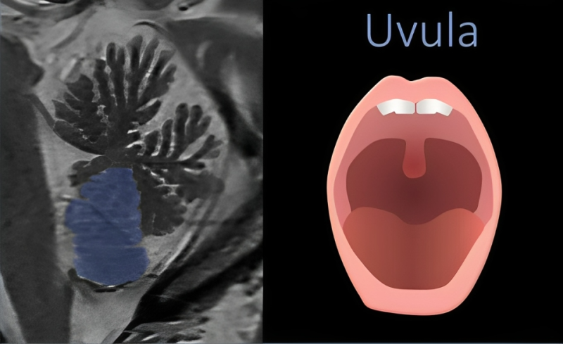 Lea Alhilali: How much cerebellar anatomy do YOU know?