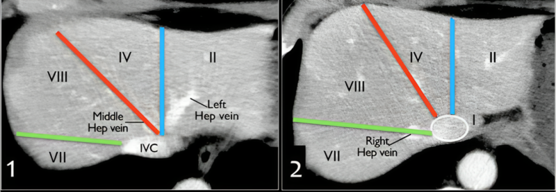 Mark Lewis: Super helpful visual reference