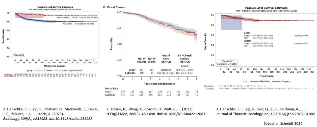 Sebastian Schmidt: Overdiagnosis in Lung Cancer (Part 3) and overtreatment - 2023 as a pivotal year with new insights