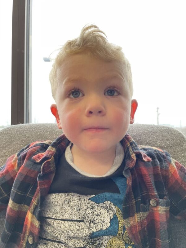 Sam Oches: Today Jude is cancer-free and happily adjusted to life with a prosthetic eye