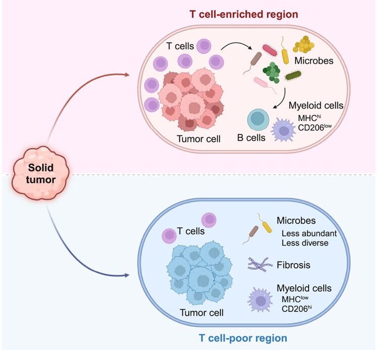 Anirban Maitra: The interplay between intratumoral microbiome and T cells