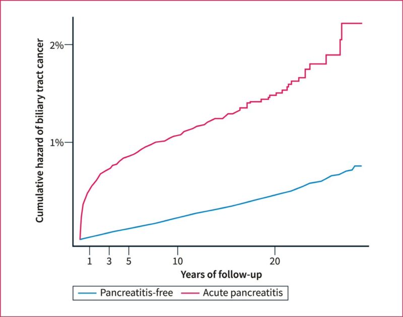 Lumír Kunovsky: Exploring the association between acute pancreatitis and biliary tract cancer