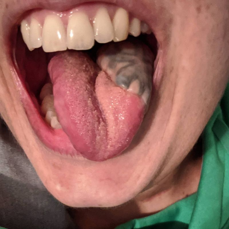 Through the lens of Stephanie Gayhart - an Oral Squamous Cell Carcinoma Survivor