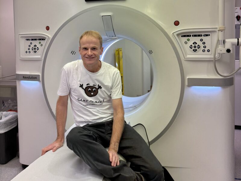 Richard Scolyer: Side effects of immunotherapy settling well