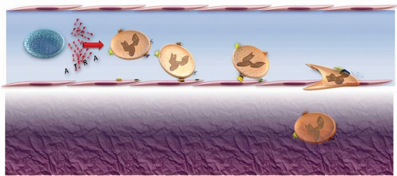 Talha Badar: Differentiation syndrome with targeted therapies for myeloid malignancies