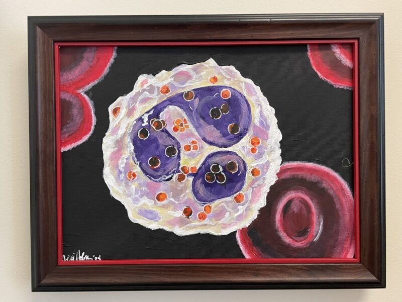 Mehdi Hamadani: The story of my CAR-T patient as painted by her continues