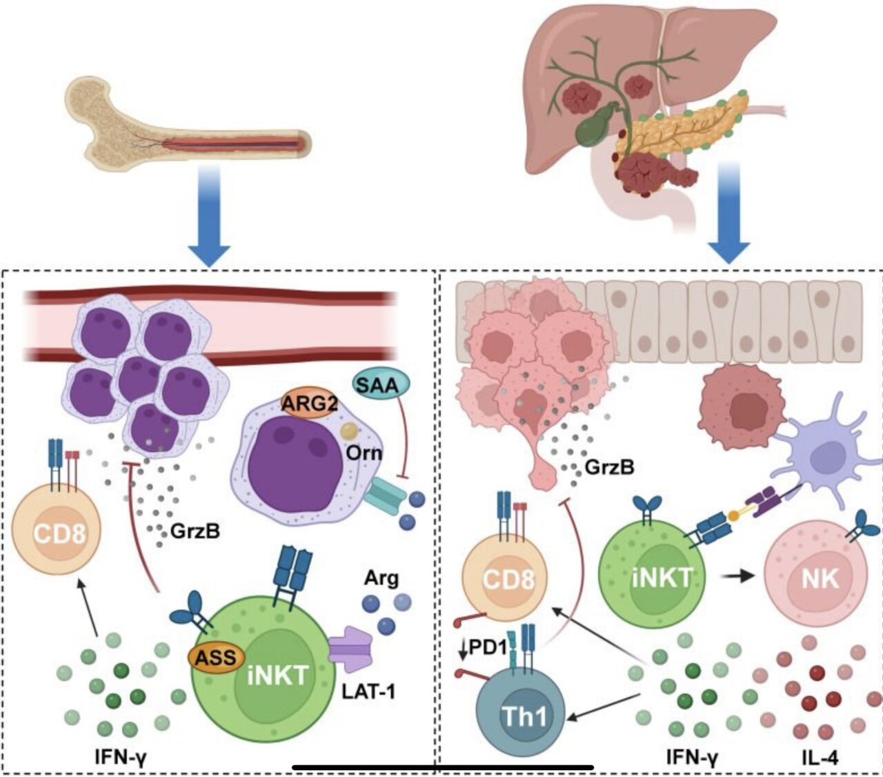 Invariant natural killer T cells response to acute myeloid leukemia and pancreatic cancer liver metastasis – Easy IMMUNO-ATMPs