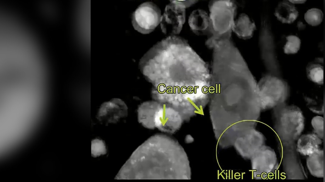 Nicolas Hubacz: T Cell Vs Cancer Cell