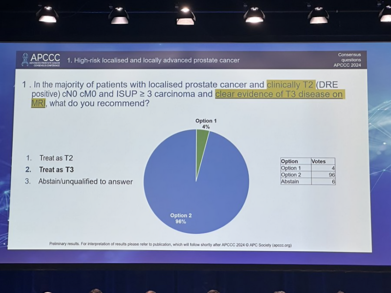 Yüksel Ürün: How do experts agree on treating high-risk localized prostate cancer with clear evidence of T3 disease on MRI?