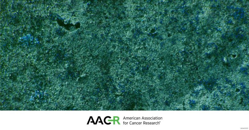 Submit an abstract by July 1 for the AACR Special Conference on Advances in Pancreatic Cancer Research