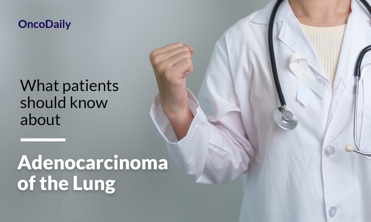 Adenocarcinoma of the Lung: What patients should know about