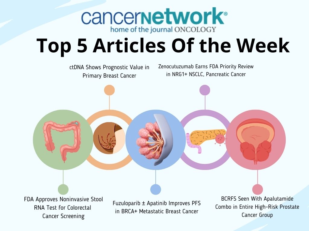 Top 5 articles of the week in Cancer Network