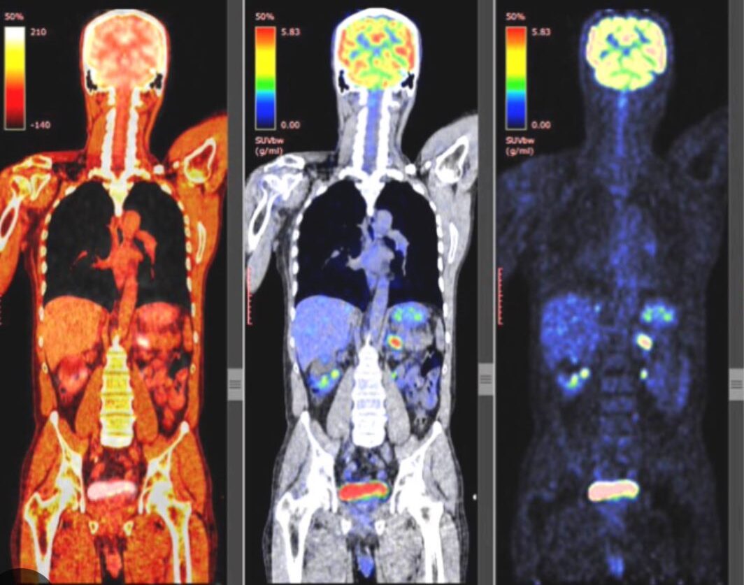 Mark Lewis: PET scans are the aurora borealis of medical imaging