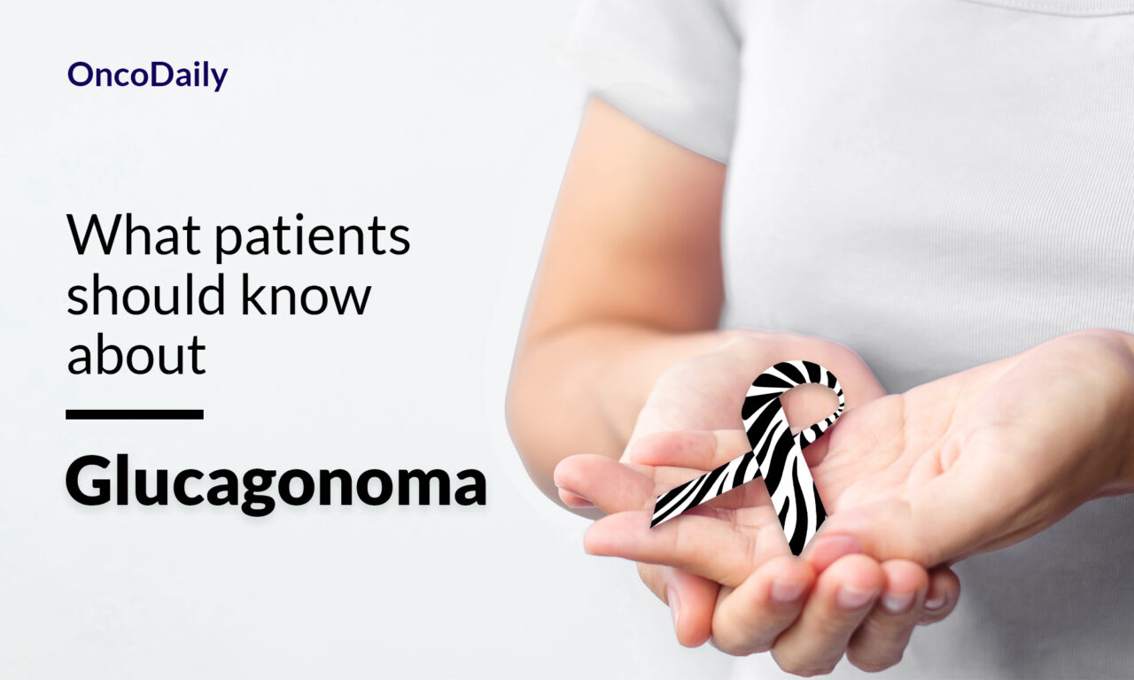 Glucagonoma: What patients should know about