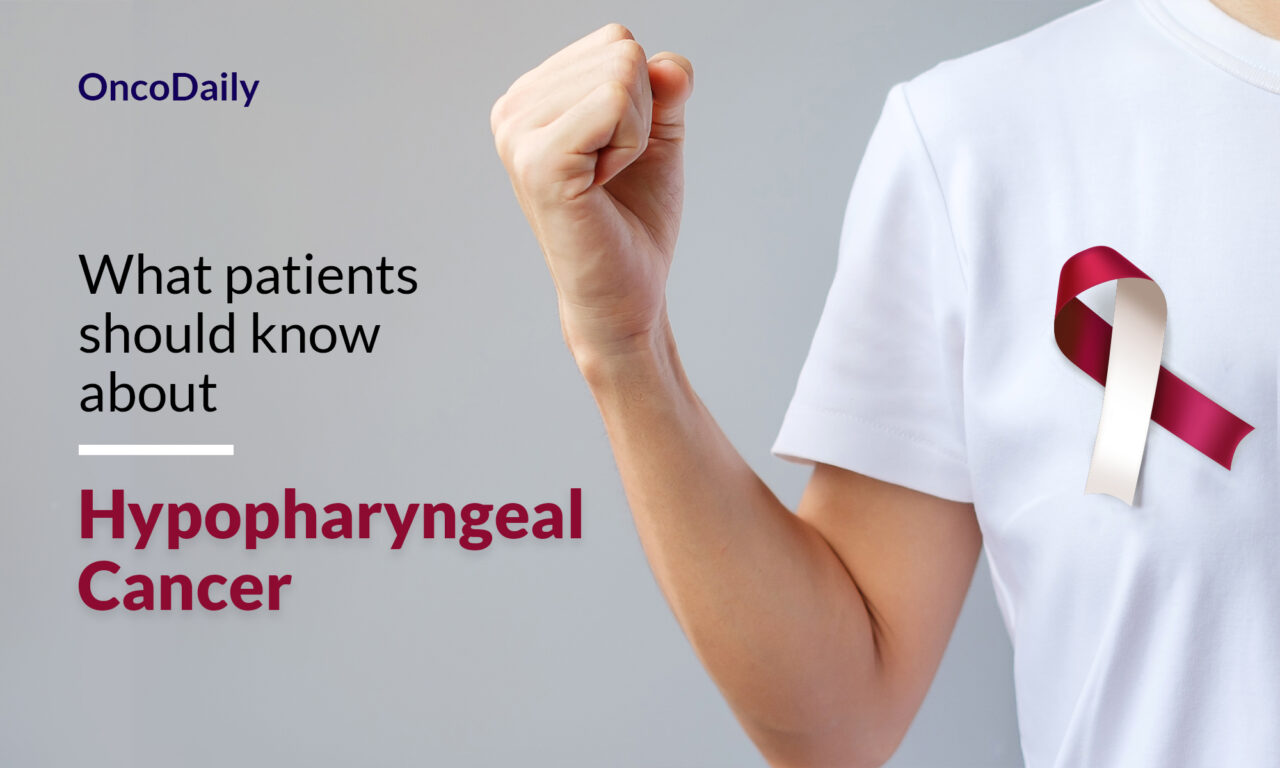 Hypopharyngeal Cancer: What patients should know about