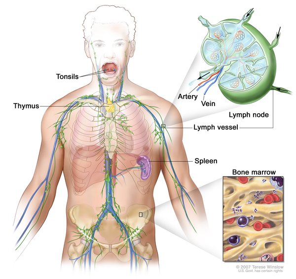 Langerhans Cell Histiocytosis