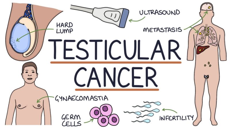 Testicular cancer symptoms