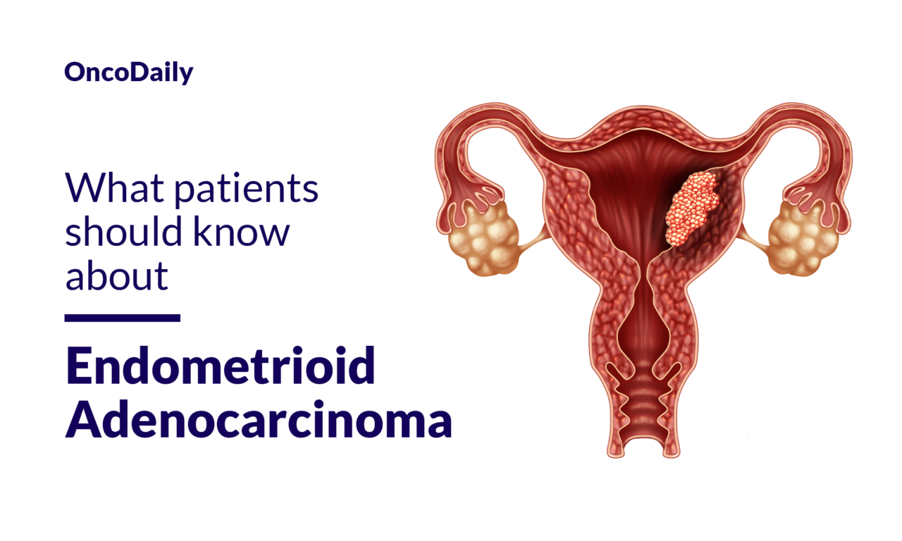 Endometrioid Adenocarcinoma: What patients should know about