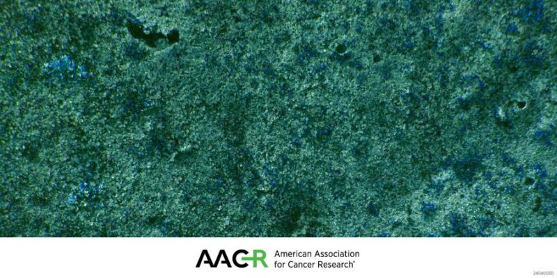 Submit an abstract by July 1 for the AACR Special Conference on Advances in Pancreatic Cancer Research