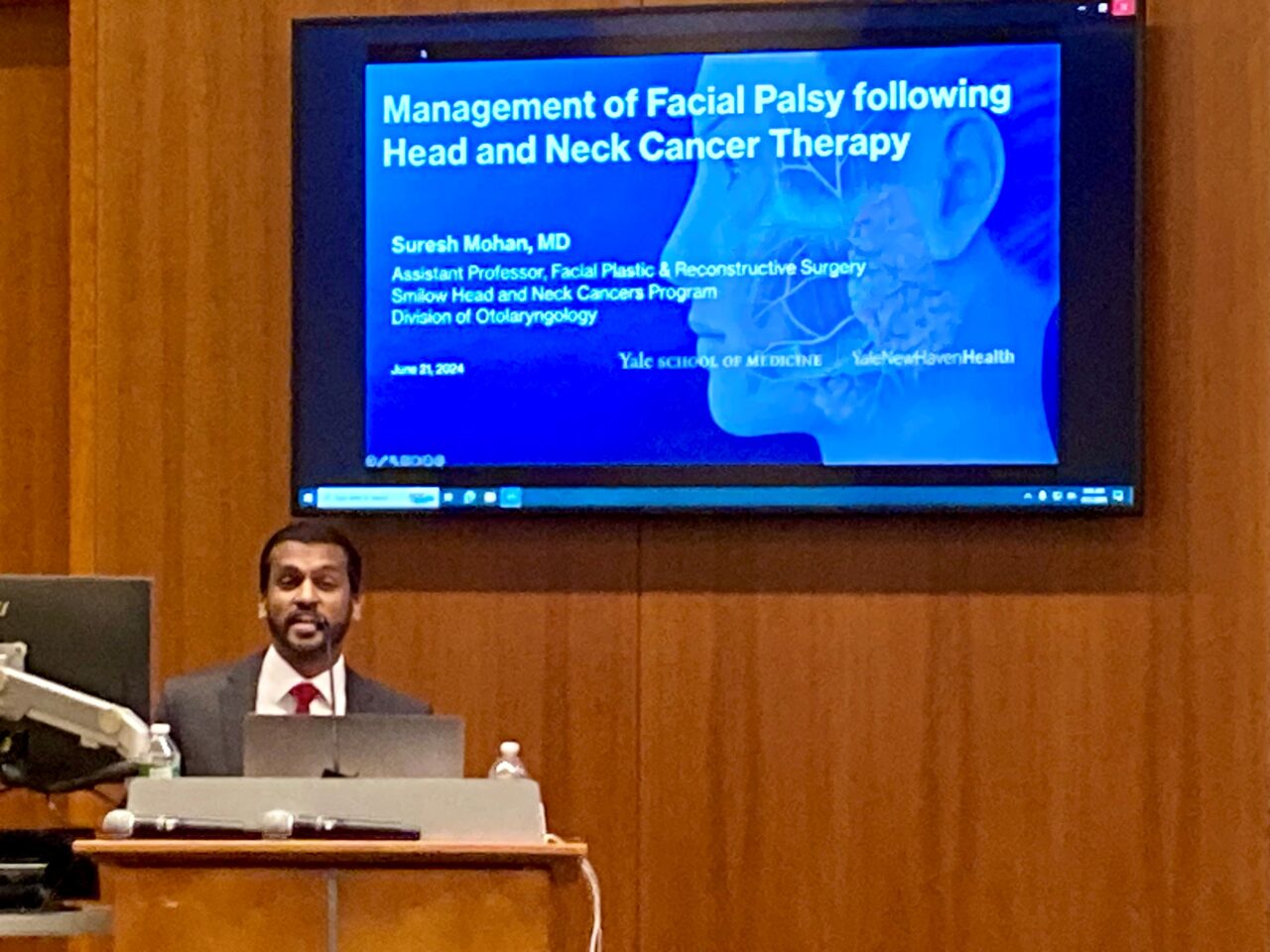 Suresh Mohan’s Grand Rounds talk on facial palsy