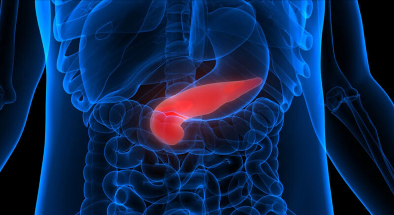 Monica Bertagnolli: Molecular Portrait of Key Driver of pancreatic cancer