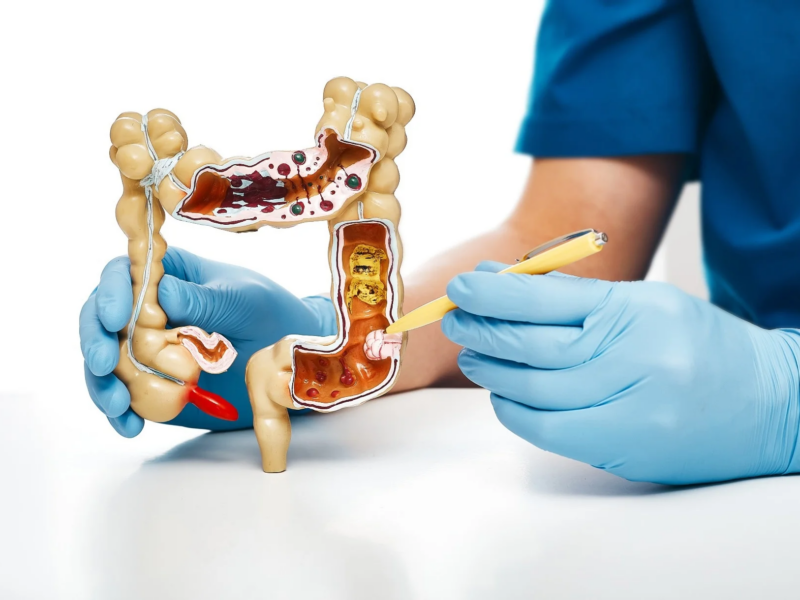 Victor Moreno: Botensilimab and balstilimab in treating heavily pre-treated patients with MSS mCRC