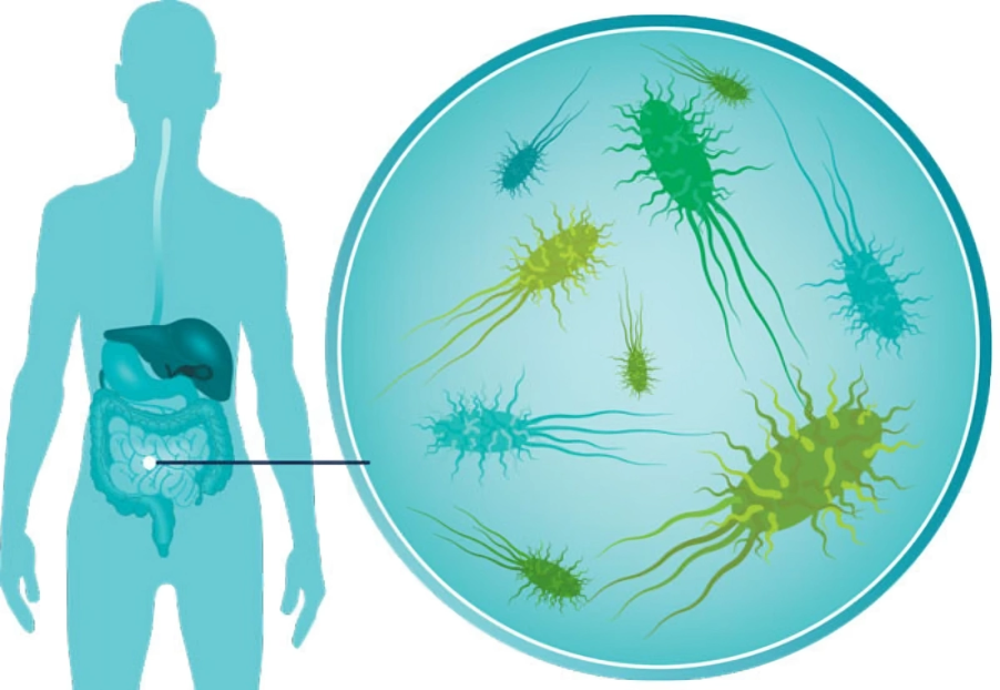 Mass General Research Institute – Particular strains of gut bacteria are more prominent in patients with IBD
