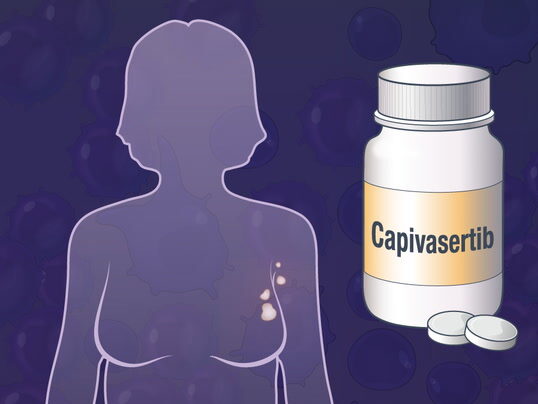 Capivasertib is now approved in EU for HR+/HER2- breast cancer