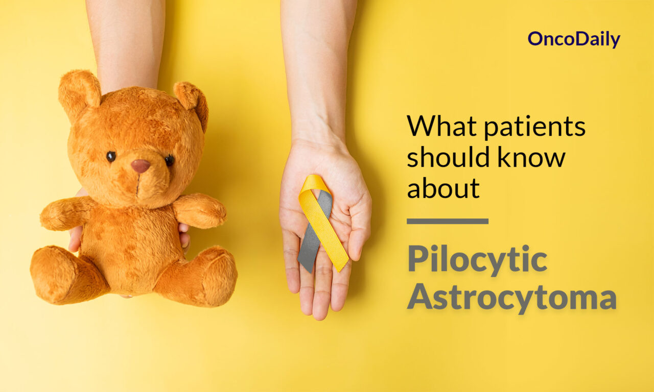 Pilocytic Astrocytoma: What patients should know about
