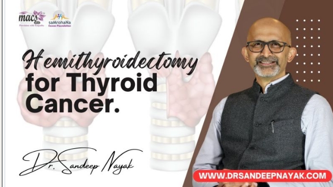 Join Dr. Sandeep Nayak as he delves into hemithyroidectomy for thyroid cancer