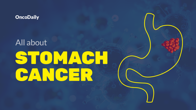 Stomach cancer - diagnosis, treatment and survival