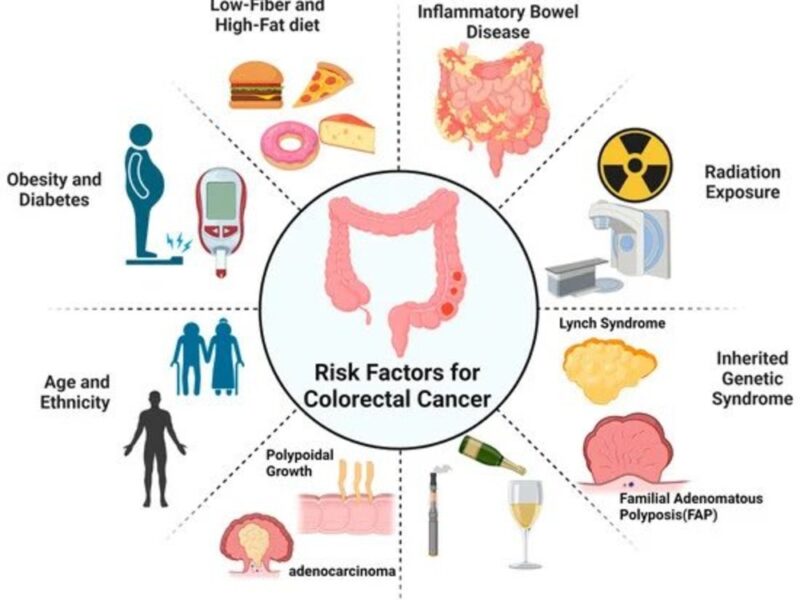 Shahrin Ahmed: Over the past 20 years, the rates of colorectal cancer among children have been risen