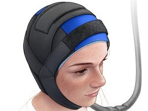 Yüksel Ürün: Scalp cooling can significantly reduce long-term hair loss after chemotherapy