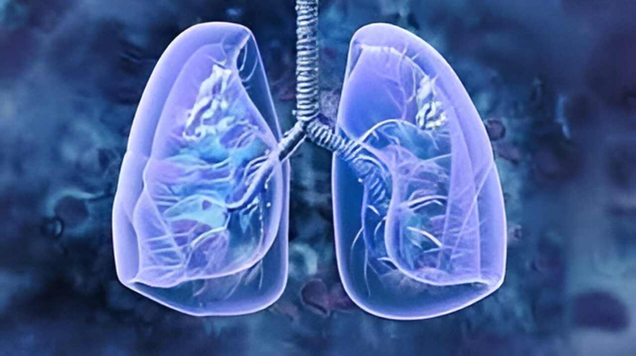 IO inductive therapy let 25% unresectable stage 3 NSCLC become resectable