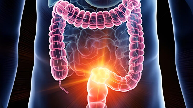 colorectal