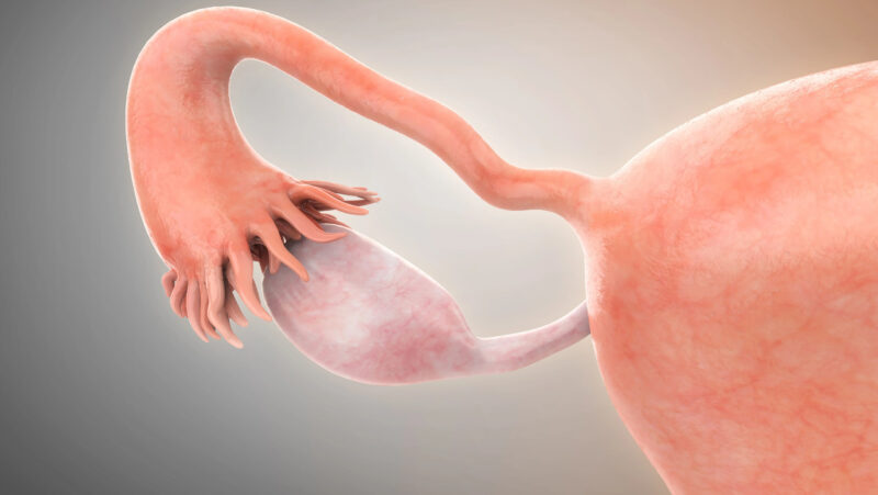 Development of TLS in different tumor sites from patients with high-grade serous ovarian cancer – Cancer Research Institute