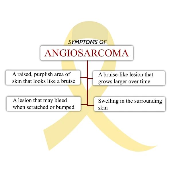 Cancer Discovery Hub – Comprehensive review paper on Angiosarcoma – an Asian-prevalent rare cancer