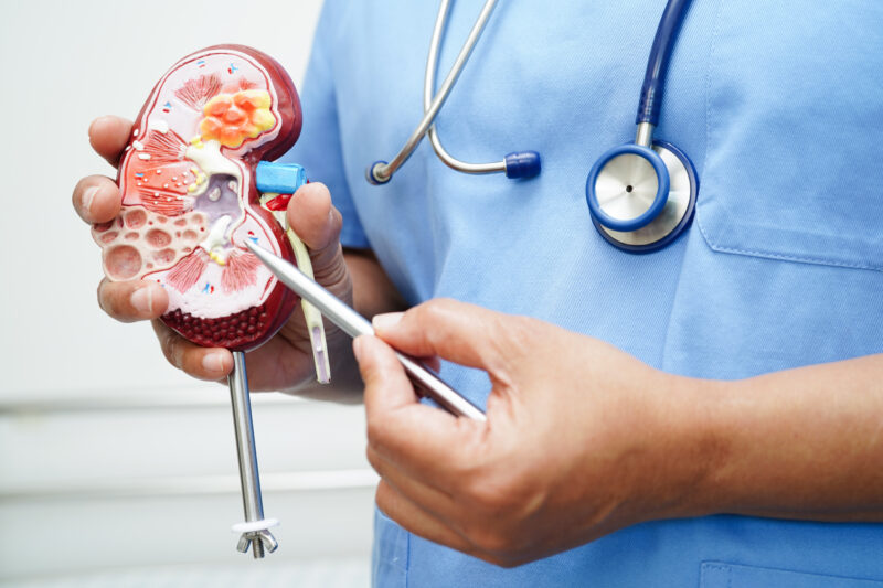 Enrique Grande: Epigenomic signatures of sarcomatoid differentiation of RCC