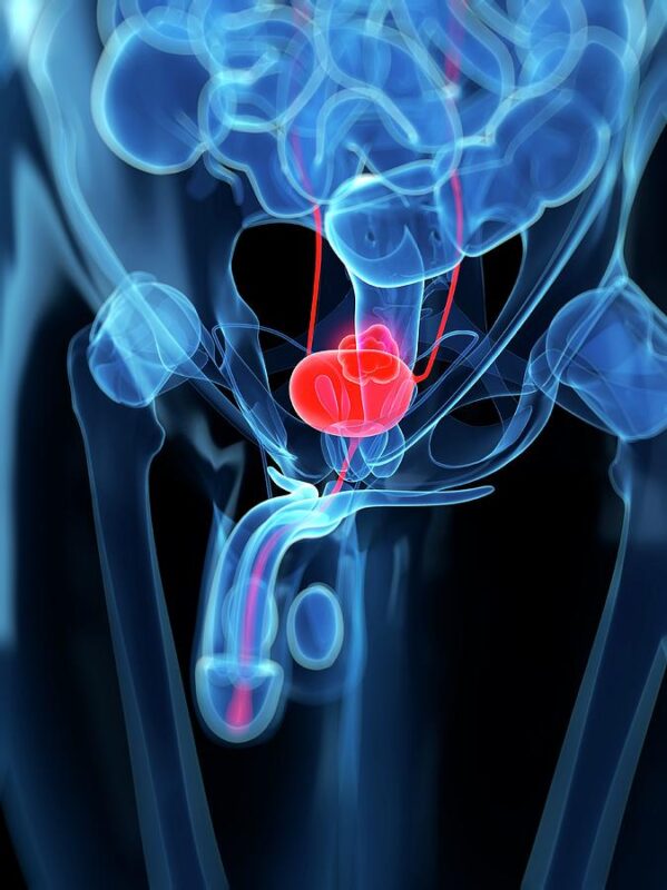 DOR to Lurbinectedin in Small Cell Bladder Cancer with TP53 Mutation